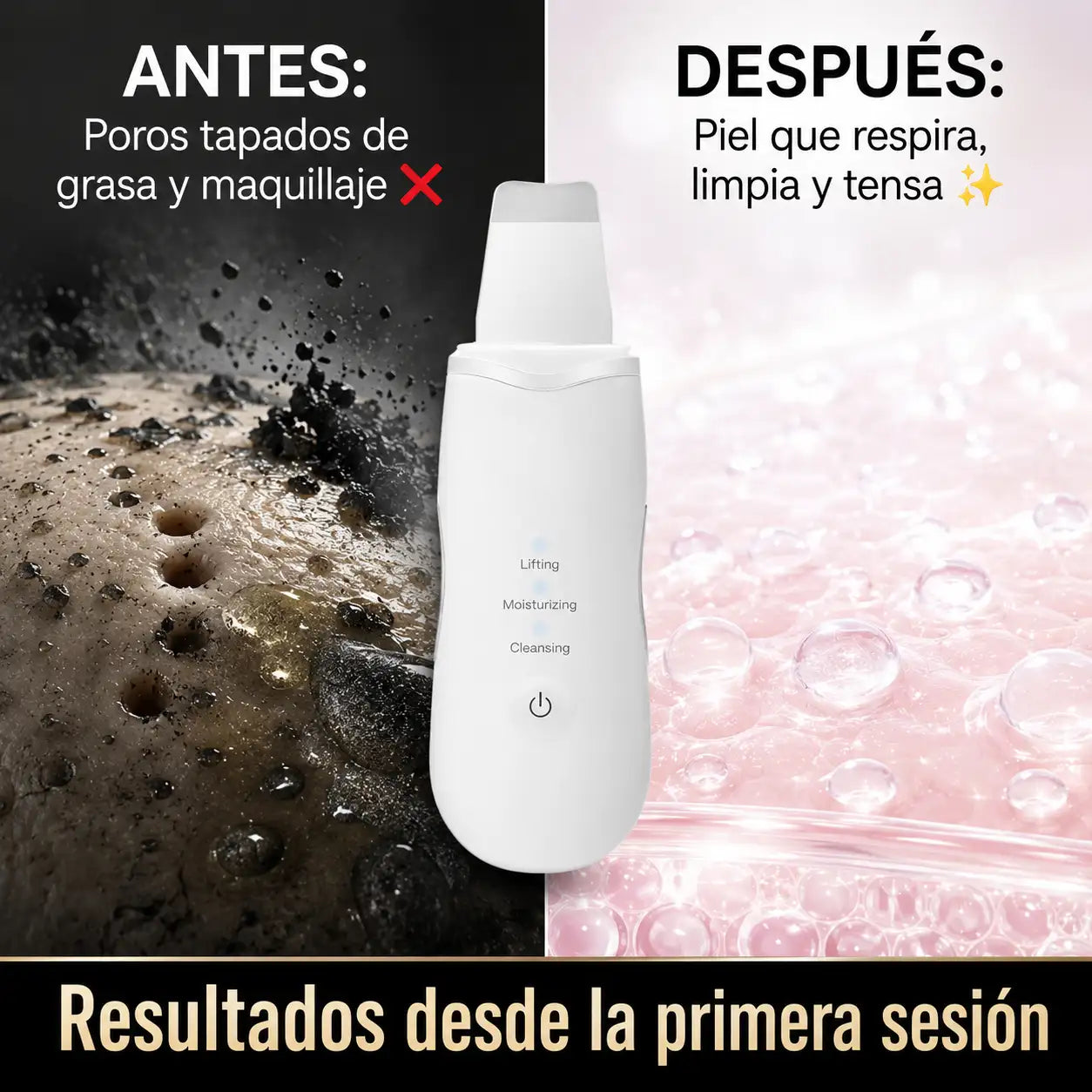 SonicPeel™ Pro - Espatula Facial Ultrasonica Exfoliante